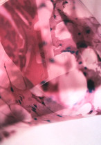 Przedstawienia wizualne inspirowane powiększeniami mikroskopowymi stwardnienia rozsianego/Dominika Jeleśniańska/2016